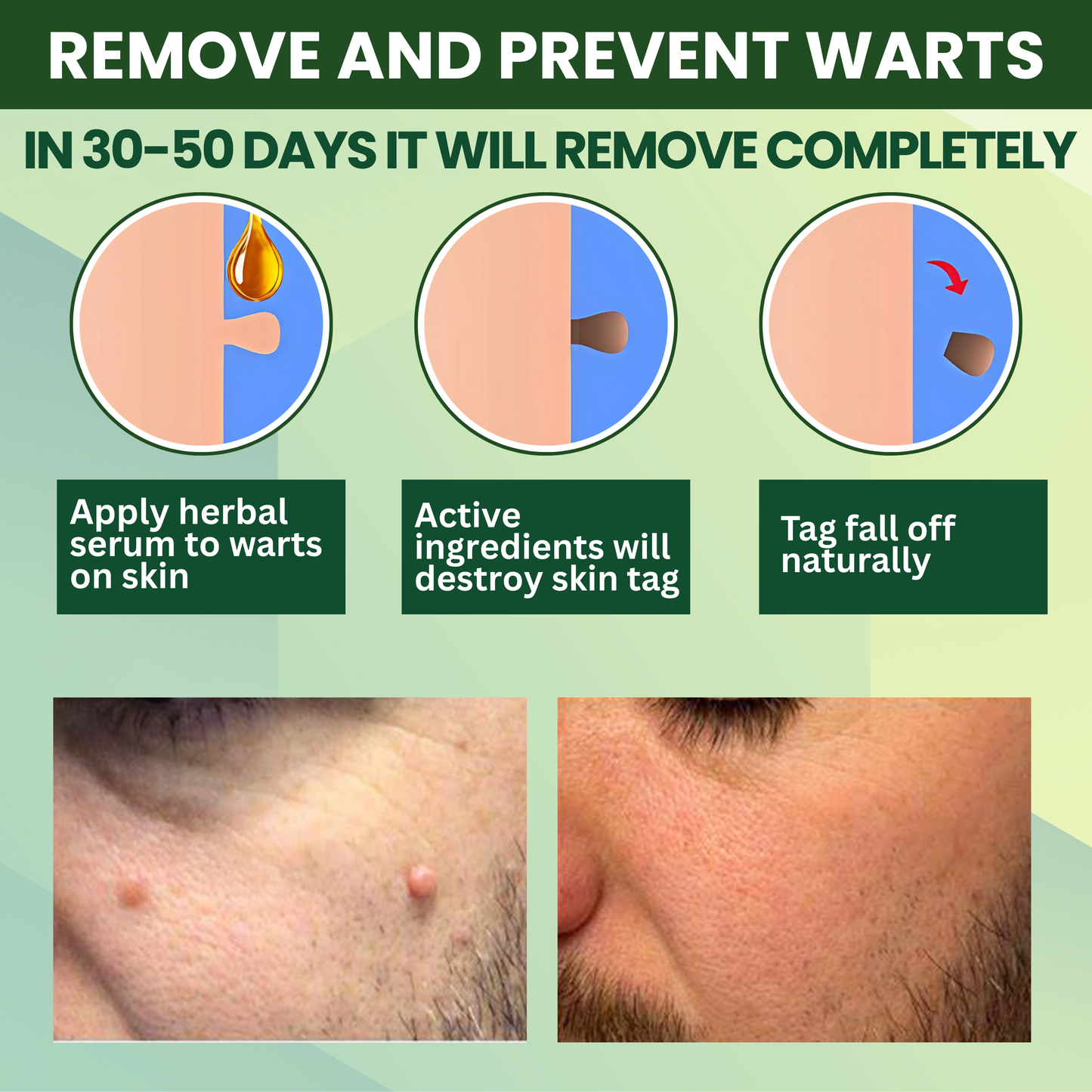 Luhaka® Reedle Shot 100 Tag & Spot Target Advanced Serum ACE