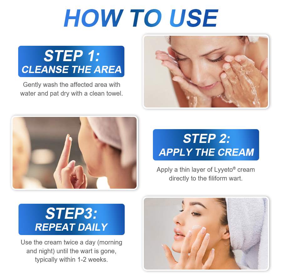 LYYETO® HPV Facial Filiform Warts Removal Cream ACE
