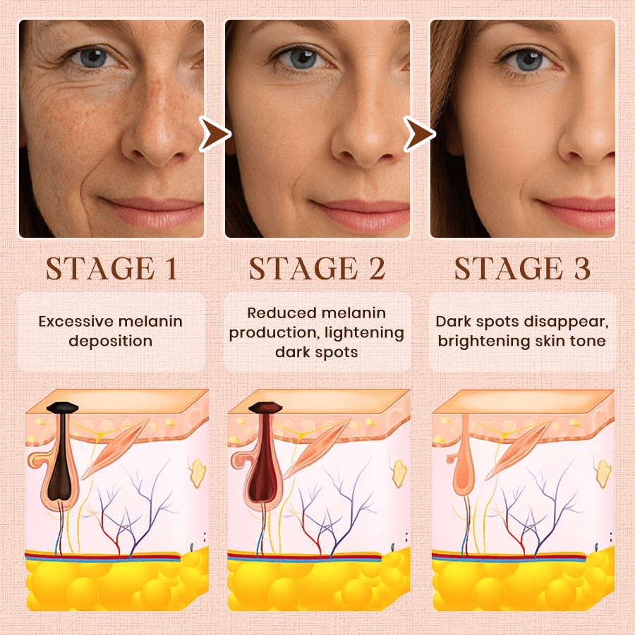 Luhaka® Purifying Exfoliating Gel for Acanthosis Nigricans, Exfoliation, Dark Spots, Skin Tags, and Eczema ✨