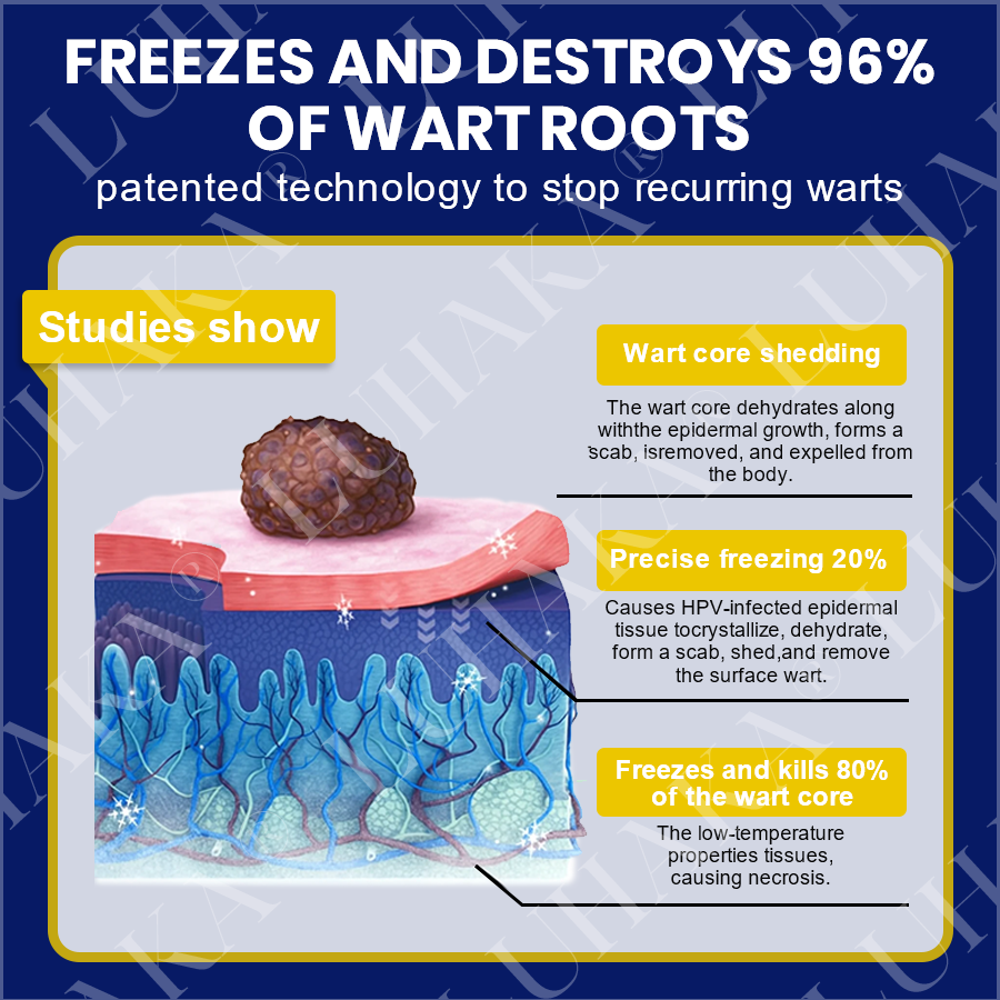 LUHAKA® SKIN TAG CRYO TREATMENT SPRAY🔷_Ultra1