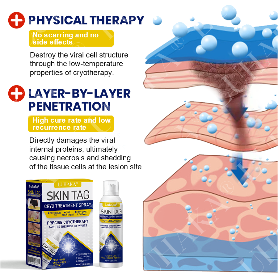 LUHAKA® SKIN TAG CRYO TREATMENT SPRAY🔷_Ultra1