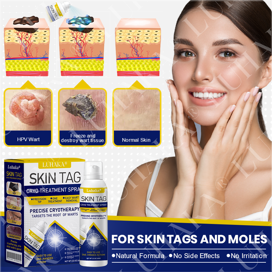 LUHAKA® SKIN TAG CRYO TREATMENT SPRAY🔷_Ultra1