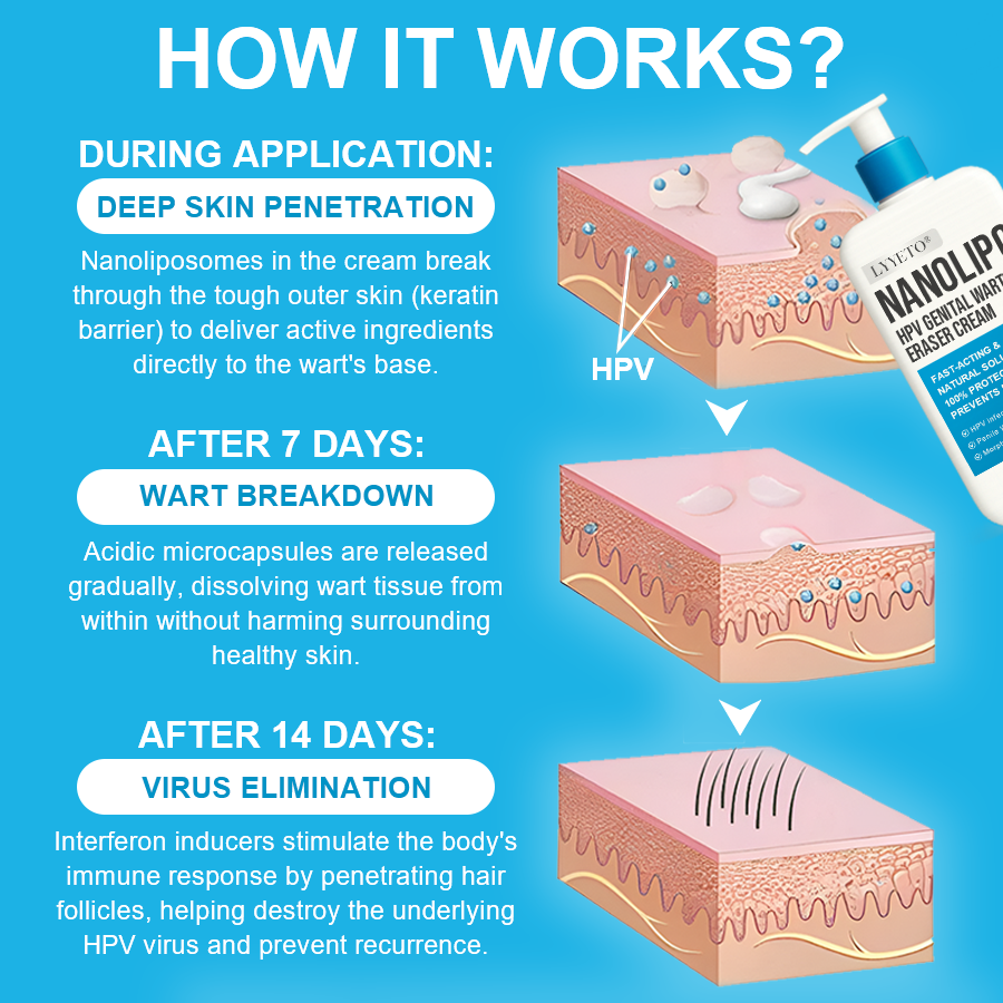 LYYETO® NANOLIPO HPV GENITAL WARTS ERASER CREAM ACE 2