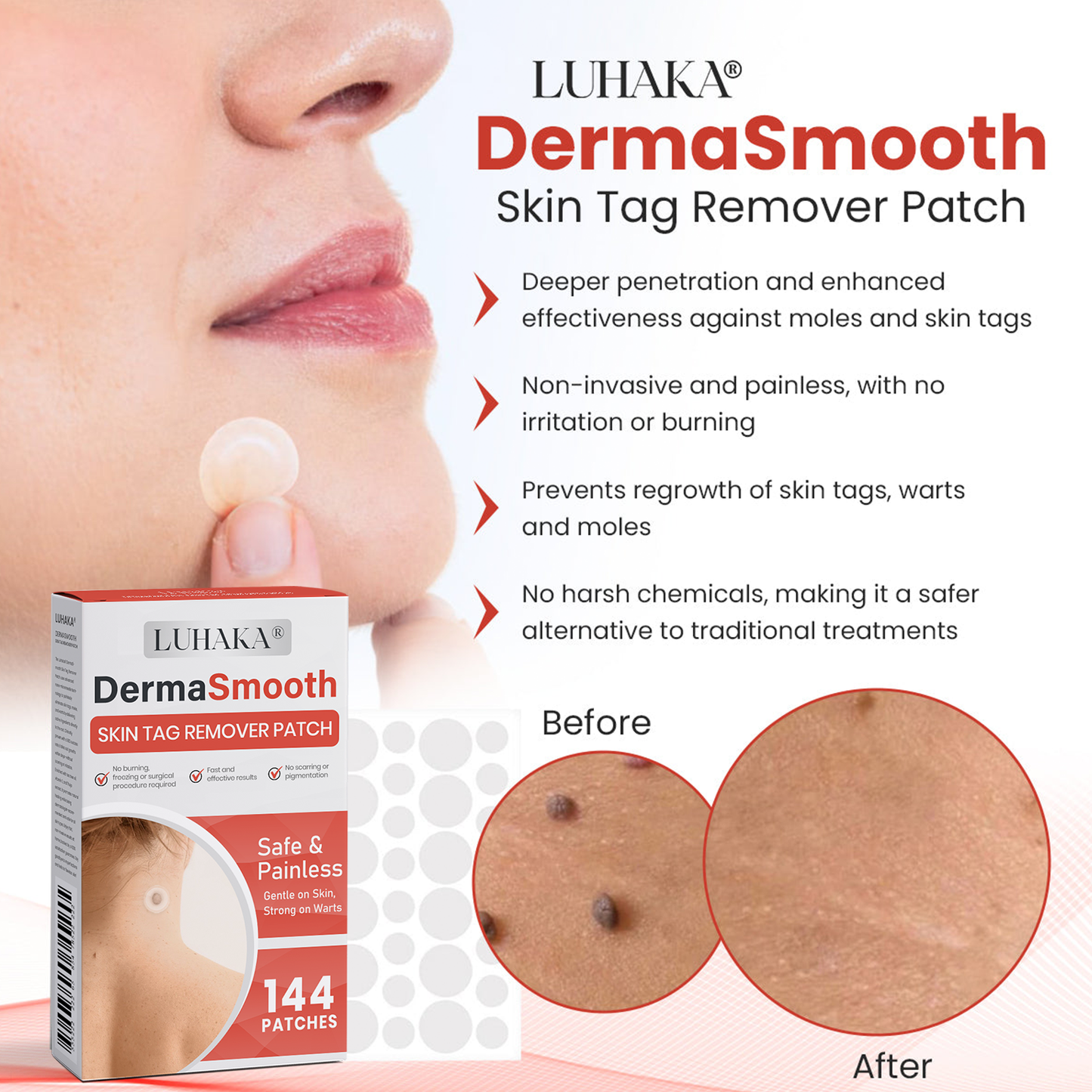 Luhaka® DermaSmooth Skin Tag Remover Patch