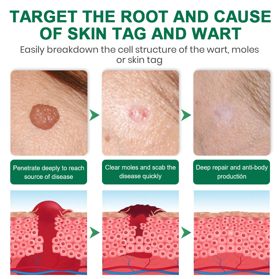 Lyyeto® Herdle Shot Spot & Mole Correct Serum ACE