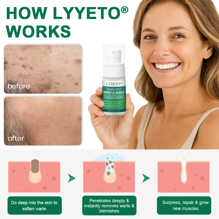 Lyyeto® Herdle Shot Spot & Mole Correct Serum ACE