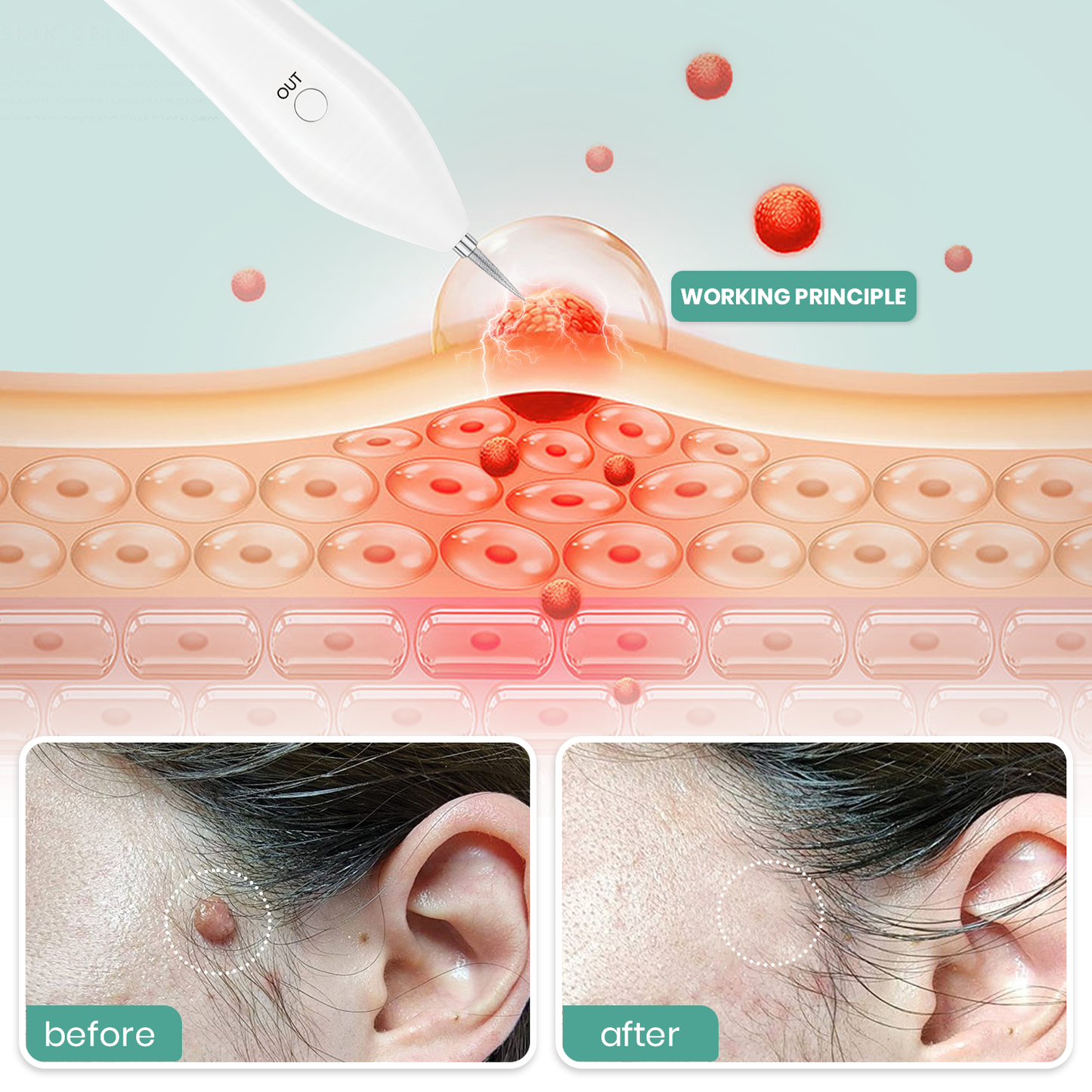 Dafeila® Advanced Plasma Laser Spot Cleaning Pen 🔥