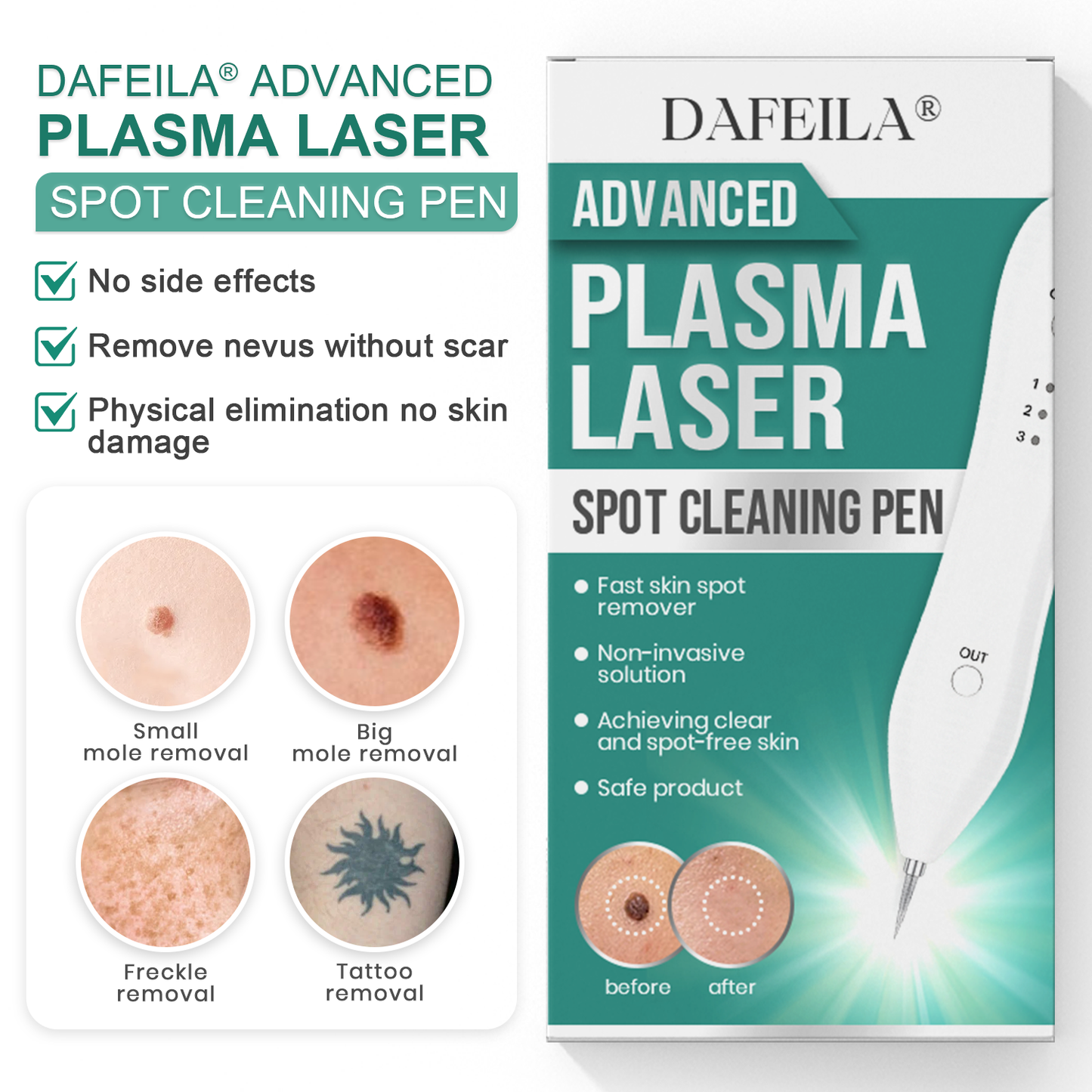Dafeila® Advanced Plasma Laser Spot Cleaning Pen 🔥