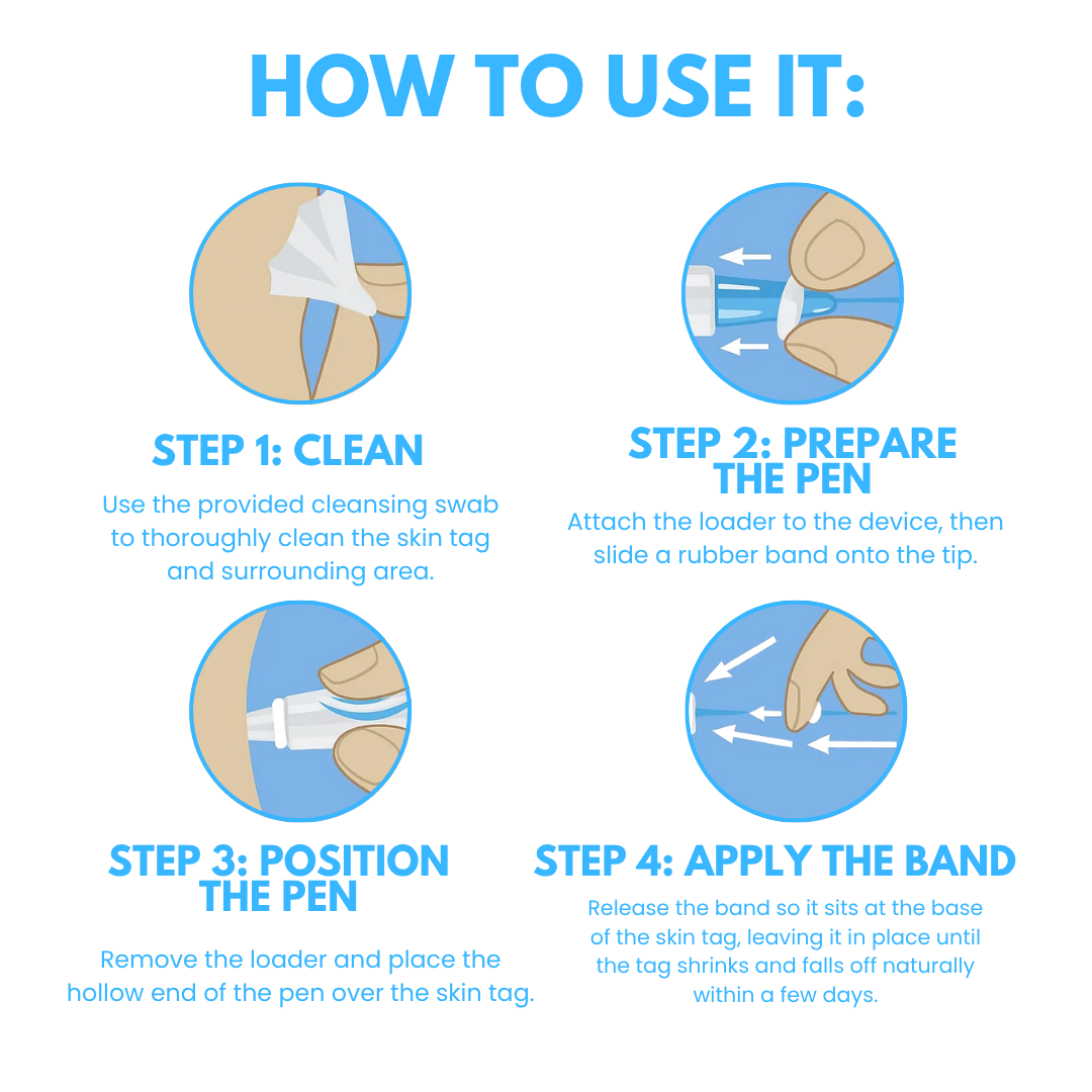 Dafeila® Skin Tag Removal Pen