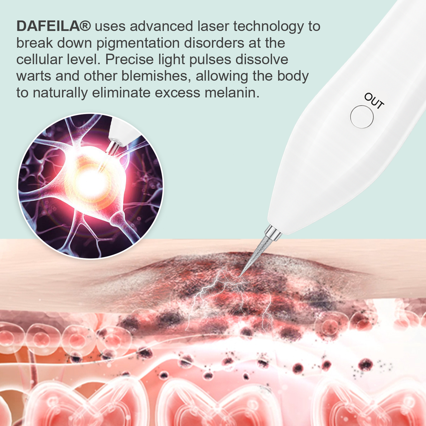 Dafeila® Advanced Plasma Laser Spot Cleaning Pen 🔥