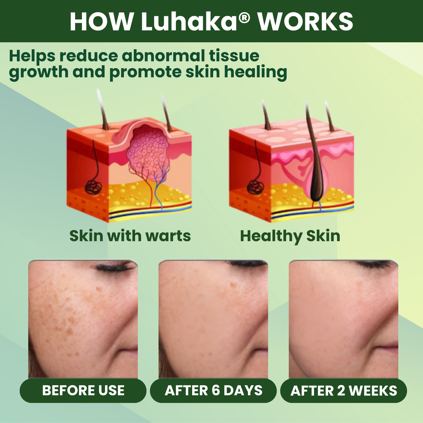 Luhaka® Reedle Shot 100 Tag & Spot Target Advanced Serum ACE