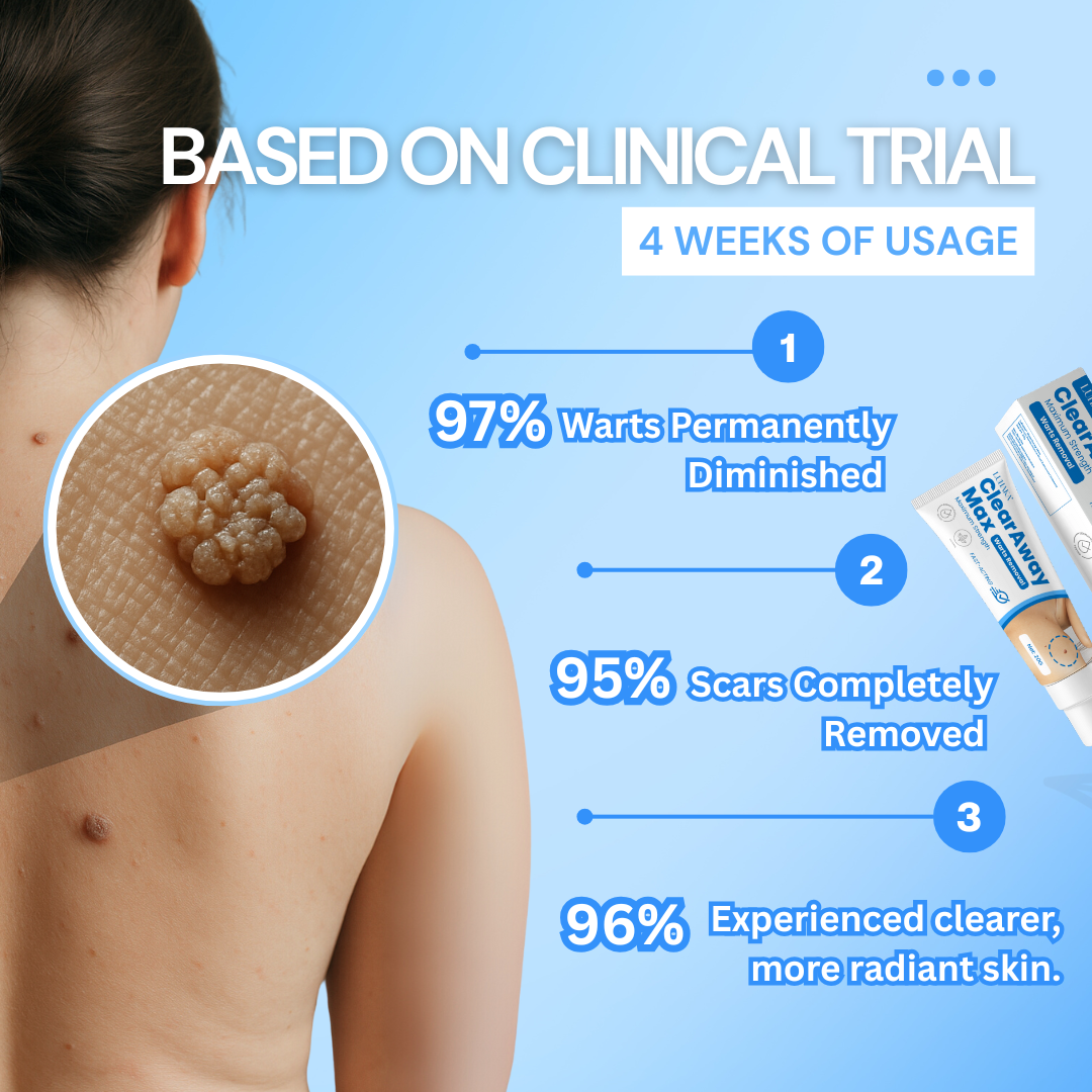 Luhaka® Clear Away Wax Warts Removal ACE 4