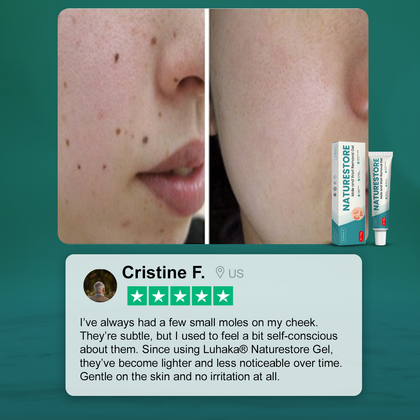 Luhaka® Naturestore Mole and Wart Removal Gel