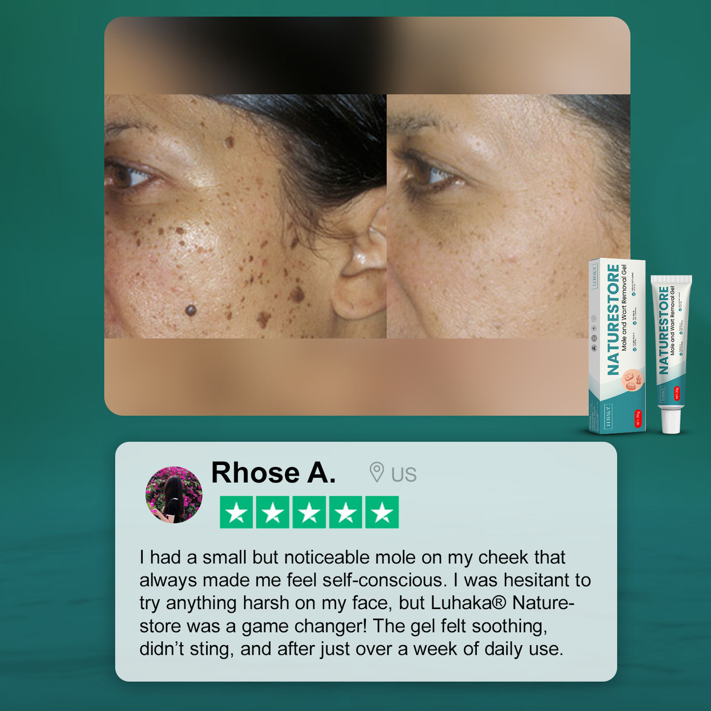 Luhaka® Naturestore Mole and Wart Removal Gel