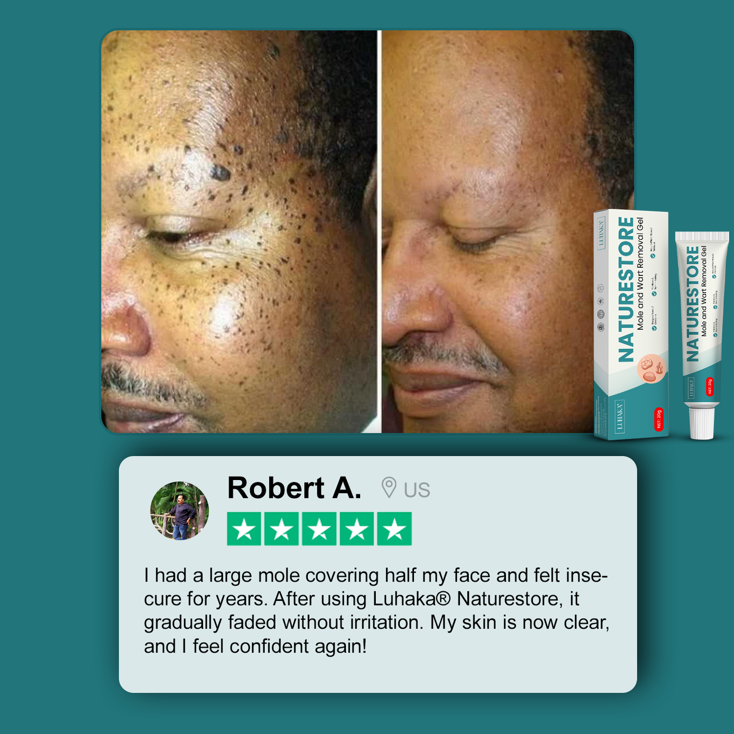 Luhaka® Naturestore Mole and Wart Removal Gel