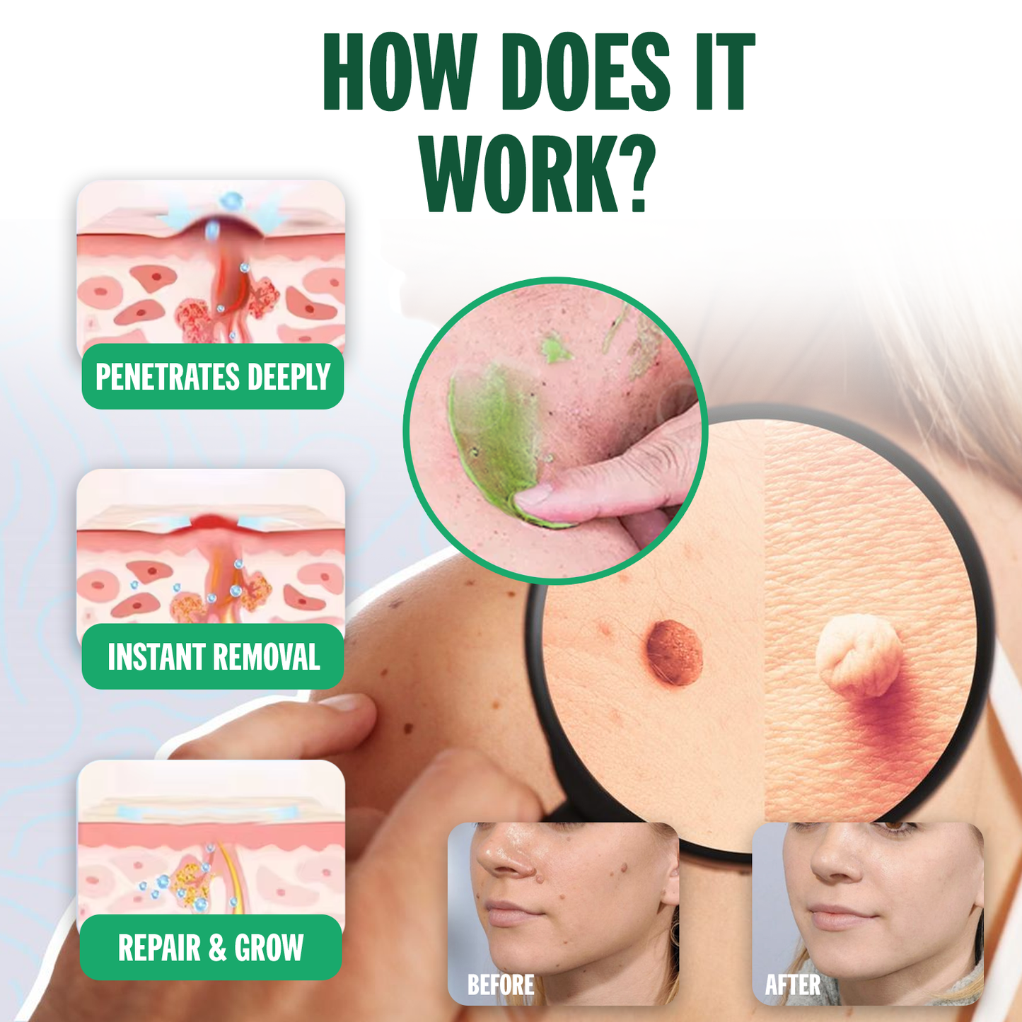 Luhaka® NATURESTORE Instant Mole & Spot Gel ☘️