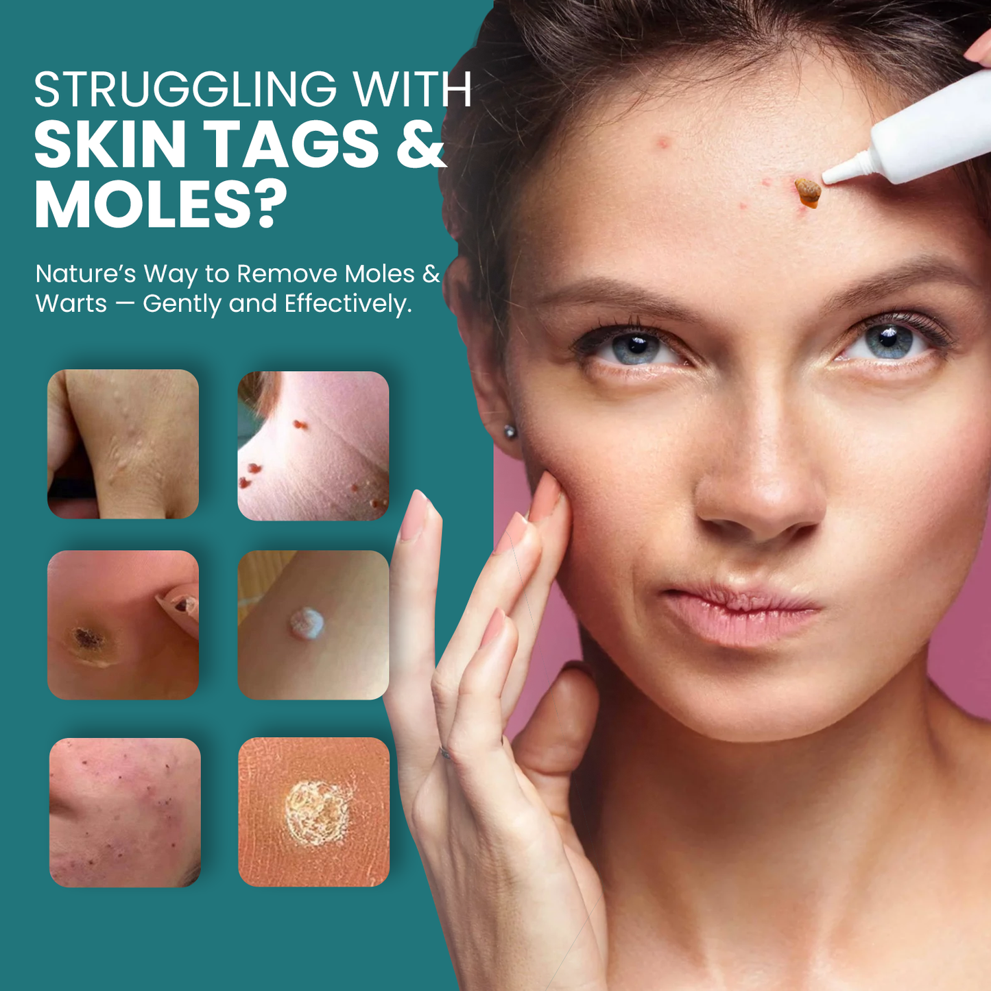 Luhaka® Naturestore Mole and Wart Removal Gel