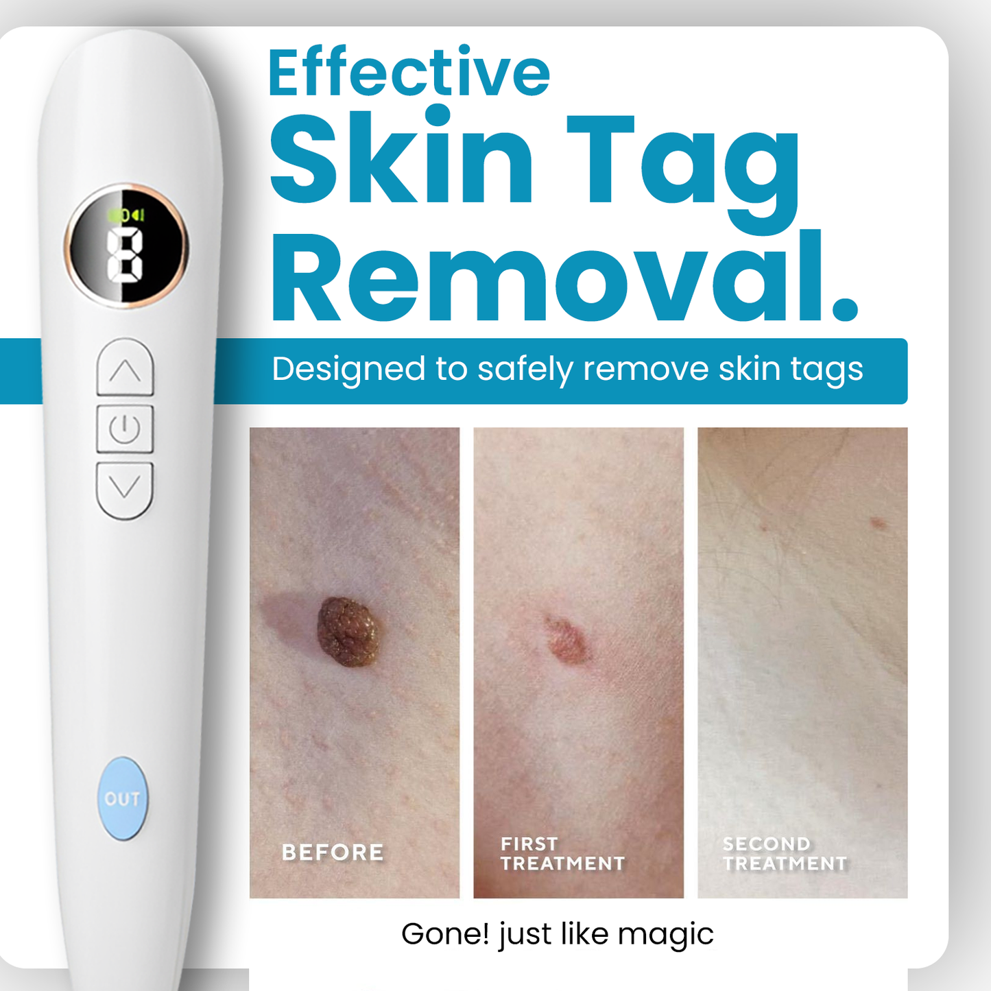 Dafeila® Shot Erase Pro 💎 2