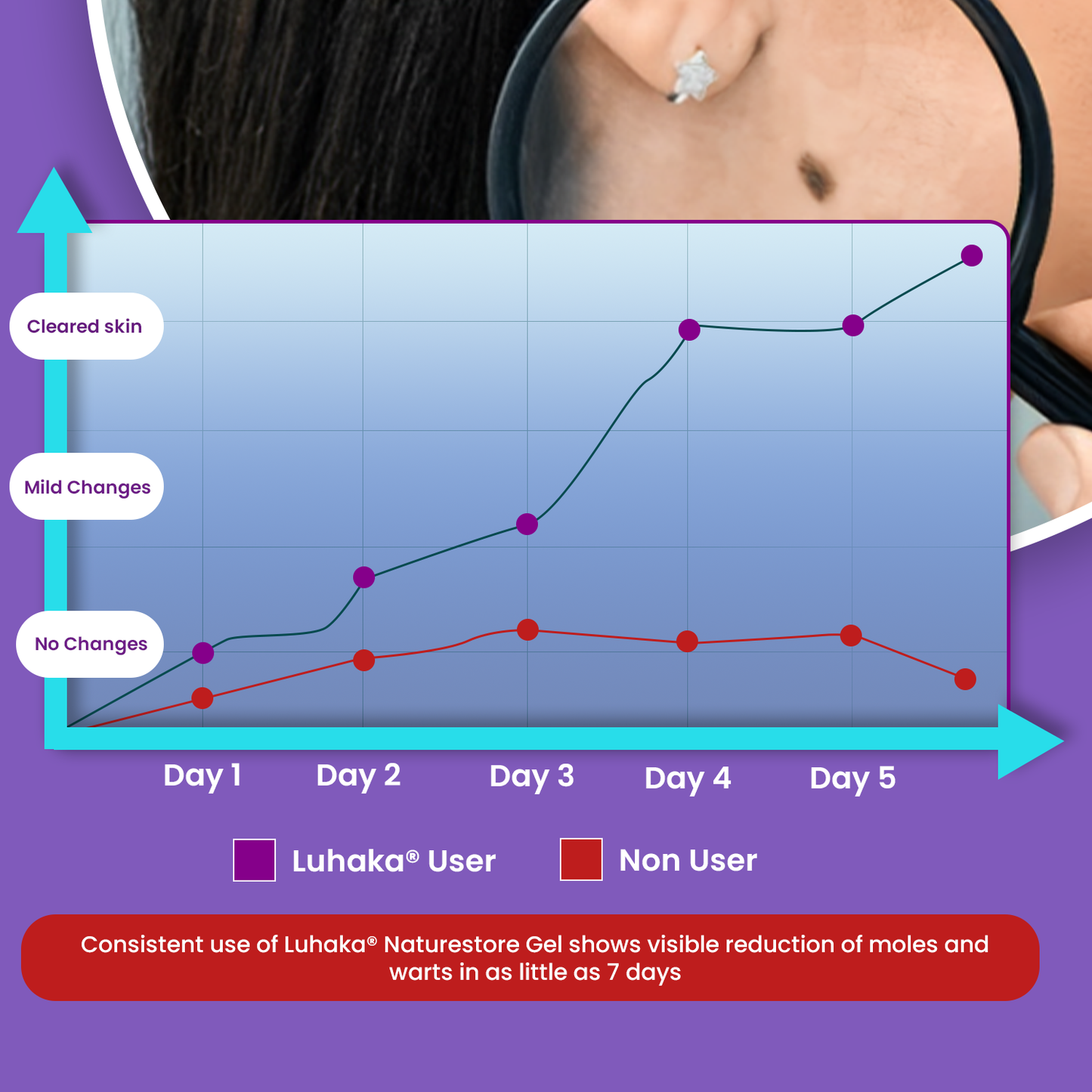 Luhaka® Naturestore Wart and Mole Removal Gel