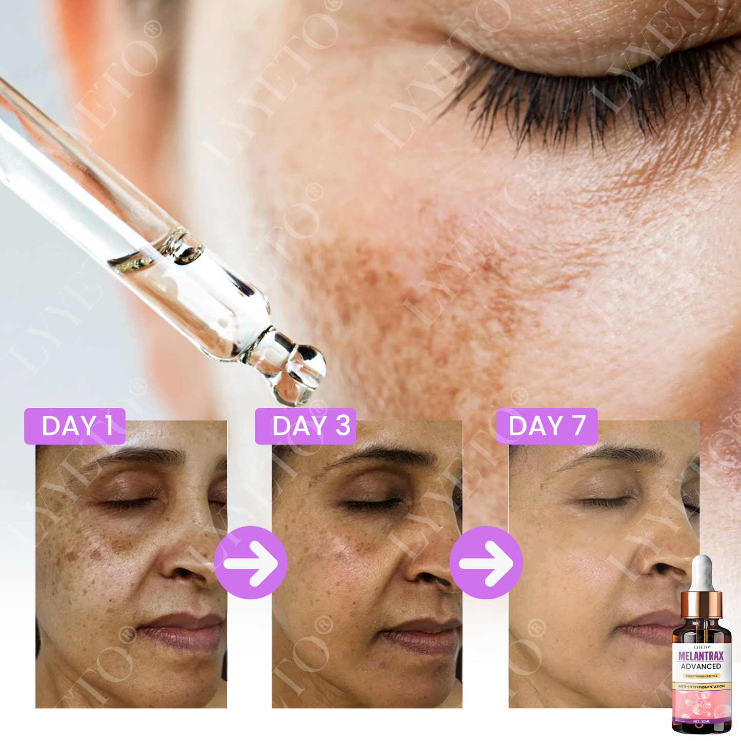 Lyyeto® MelantraX Advanced Brightening Essence ACE