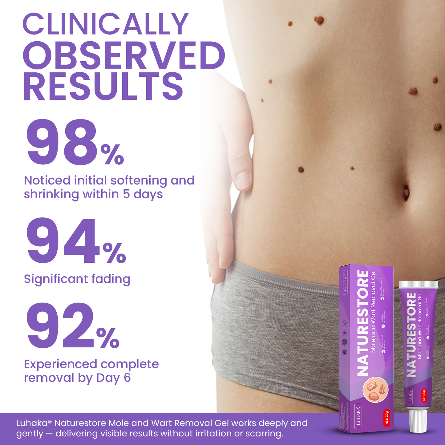 Luhaka® Naturestore Wart and Mole Removal Gel