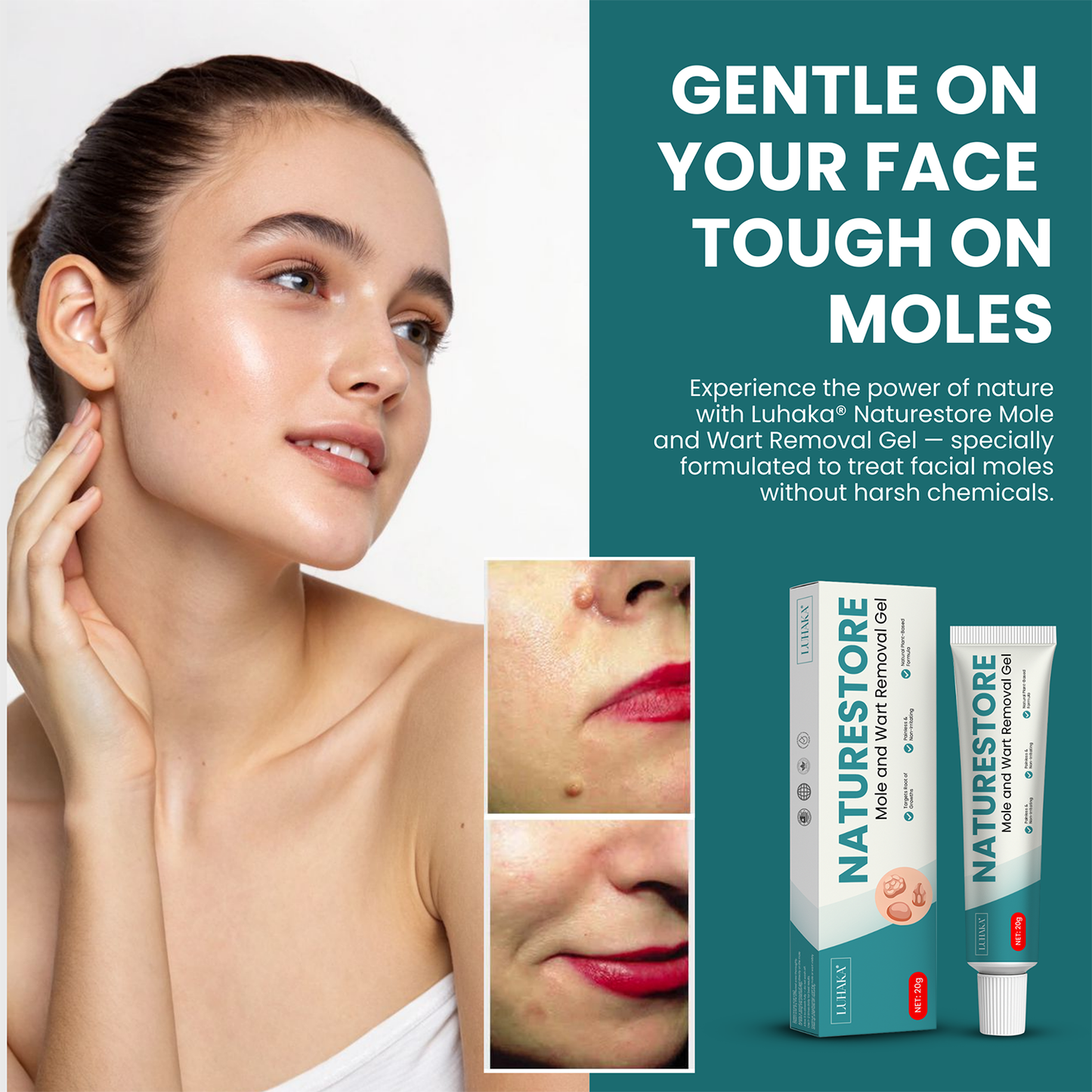 Luhaka® Naturestore Mole and Wart Removal Gel