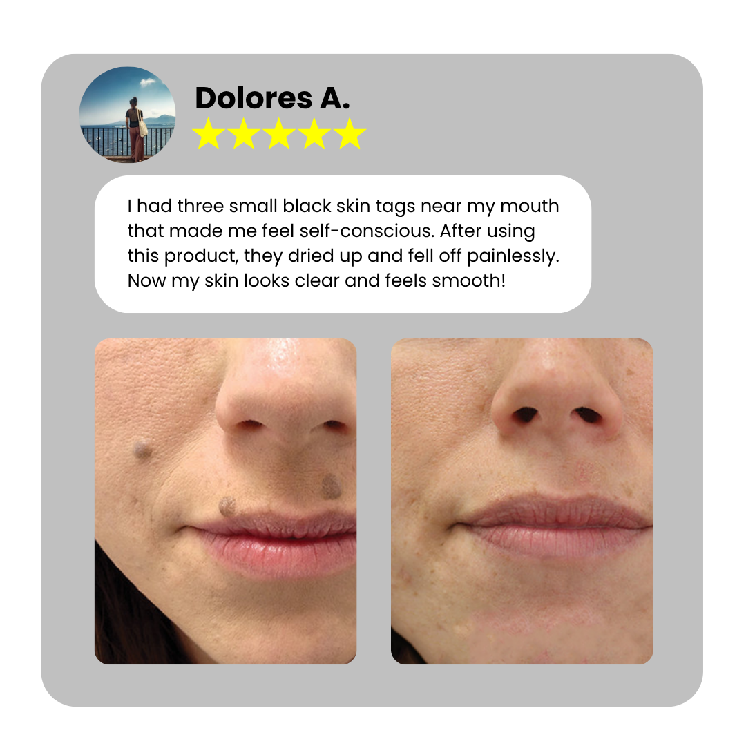 Dafeila® Shot Erase Pro 💎 2