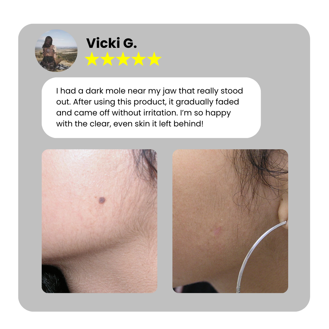 Dafeila® Shot Erase Pro 💎 2