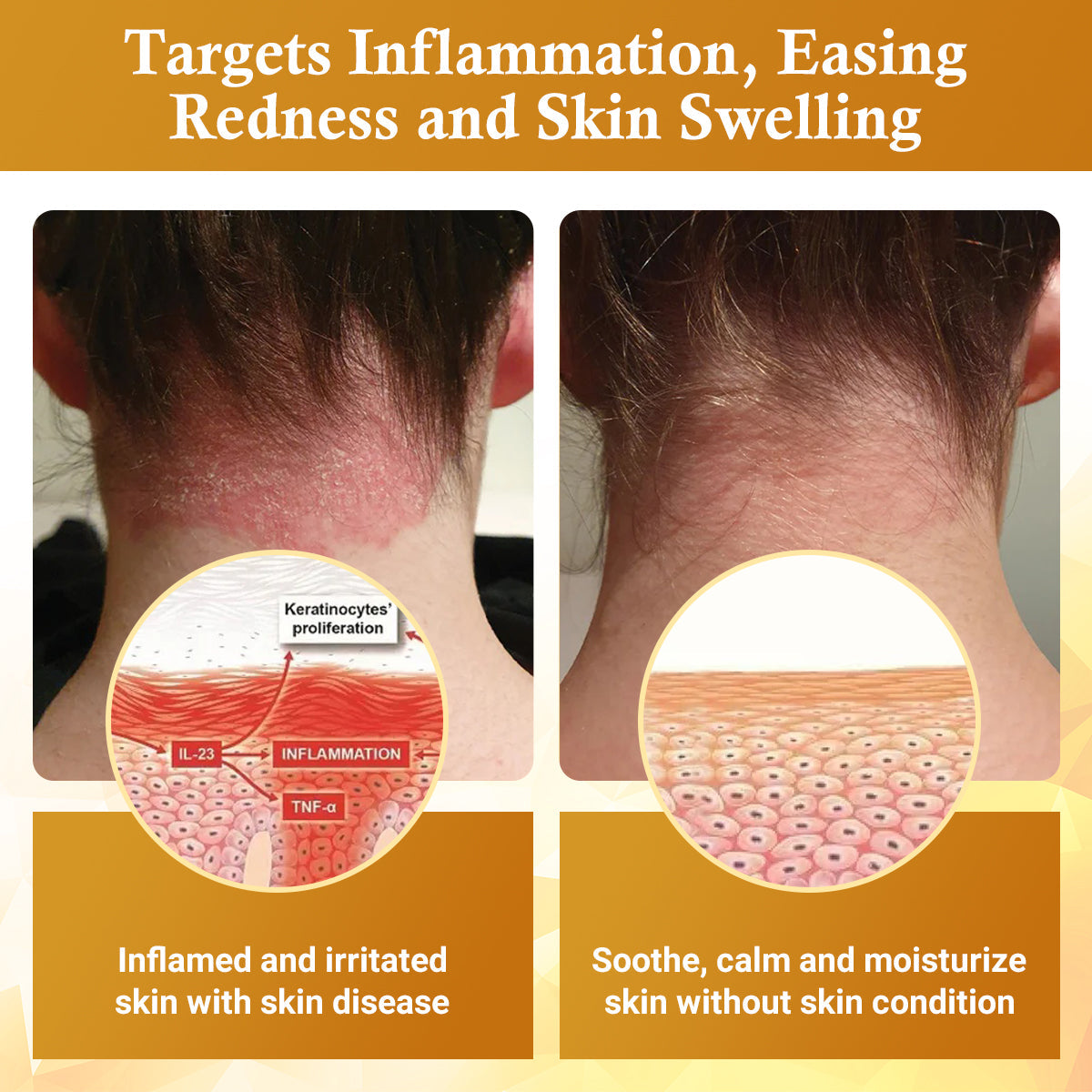 Luhaka® DermaFix Condense Mellifera Venom Skin Repairing Cream ACE 1