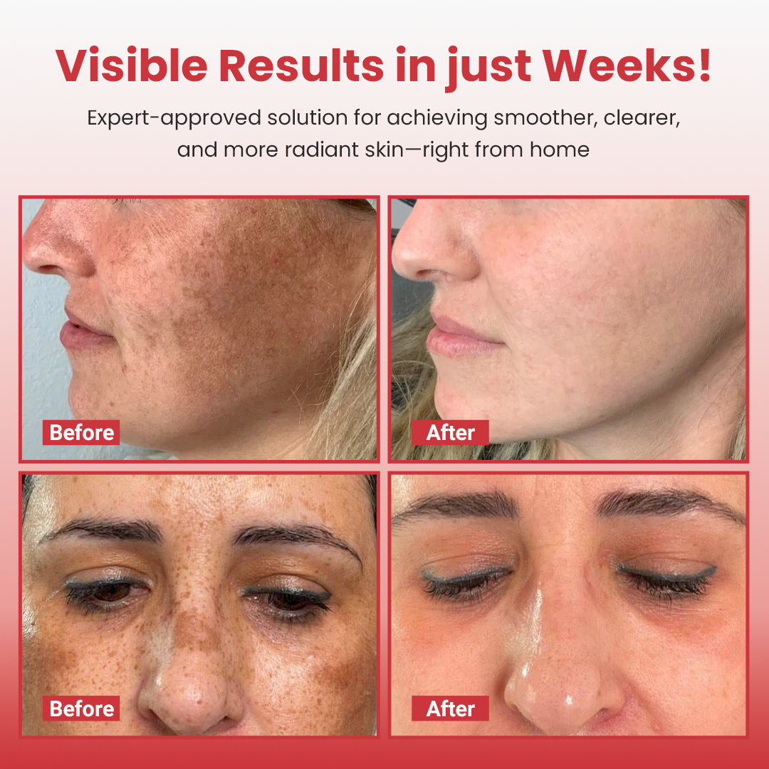 medloube Hypochlorous Acid Rice Peel Shot Duo ACE 4