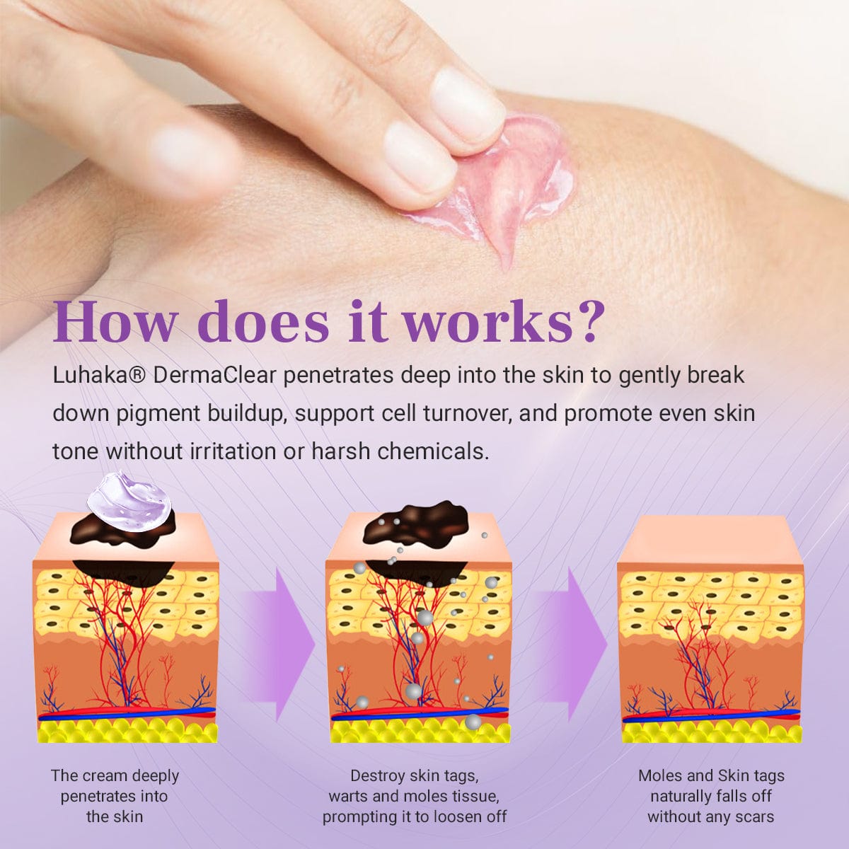 Luhaka® DermaClear Mole and Dark Spot Removal Bio-Gel_Ultra01
