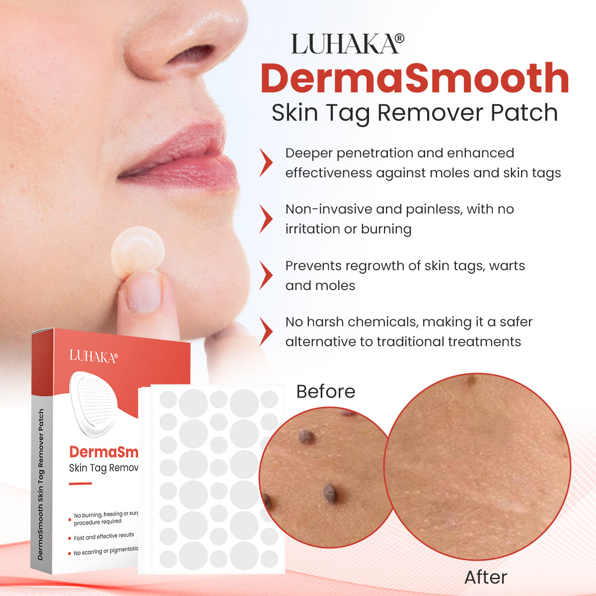 Luhaka® DermaSmooth Skin Tag Remover Patch 1