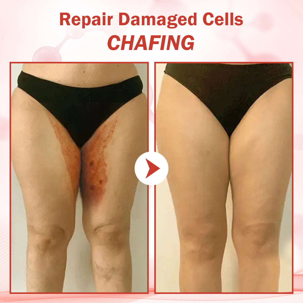 Luhaka® PureSkin Microneedle Botanic Skin Tag Removal Patch ACE 1