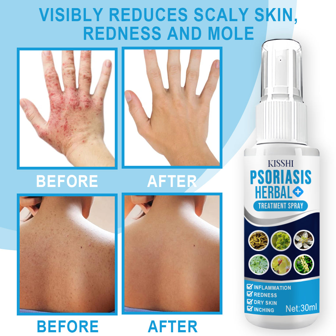 KISSHI™ Psoriasis Herbal Treatment Spray