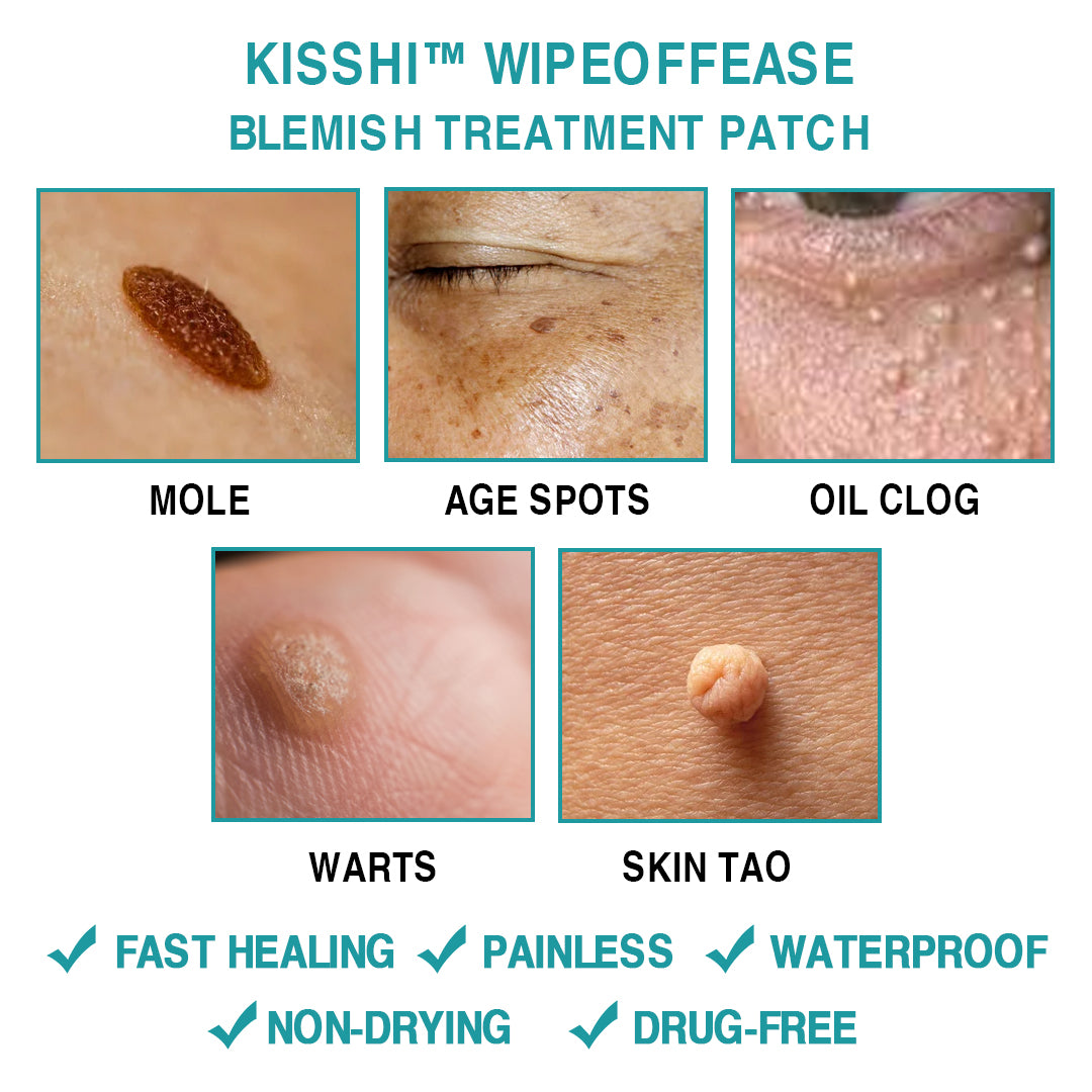 KISSHI™ WipeOffEase Blemish Treatment Patch