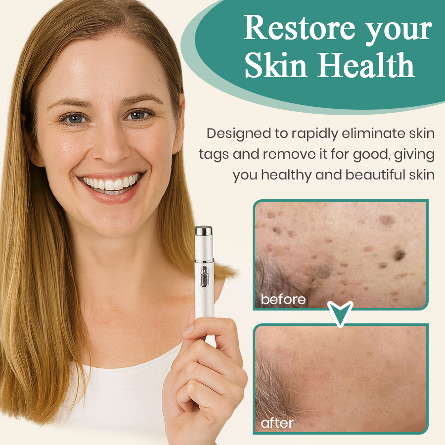 DAFEILA® LumeSkin Mole and Wart Instant Removal Laser Pen_Ultra03