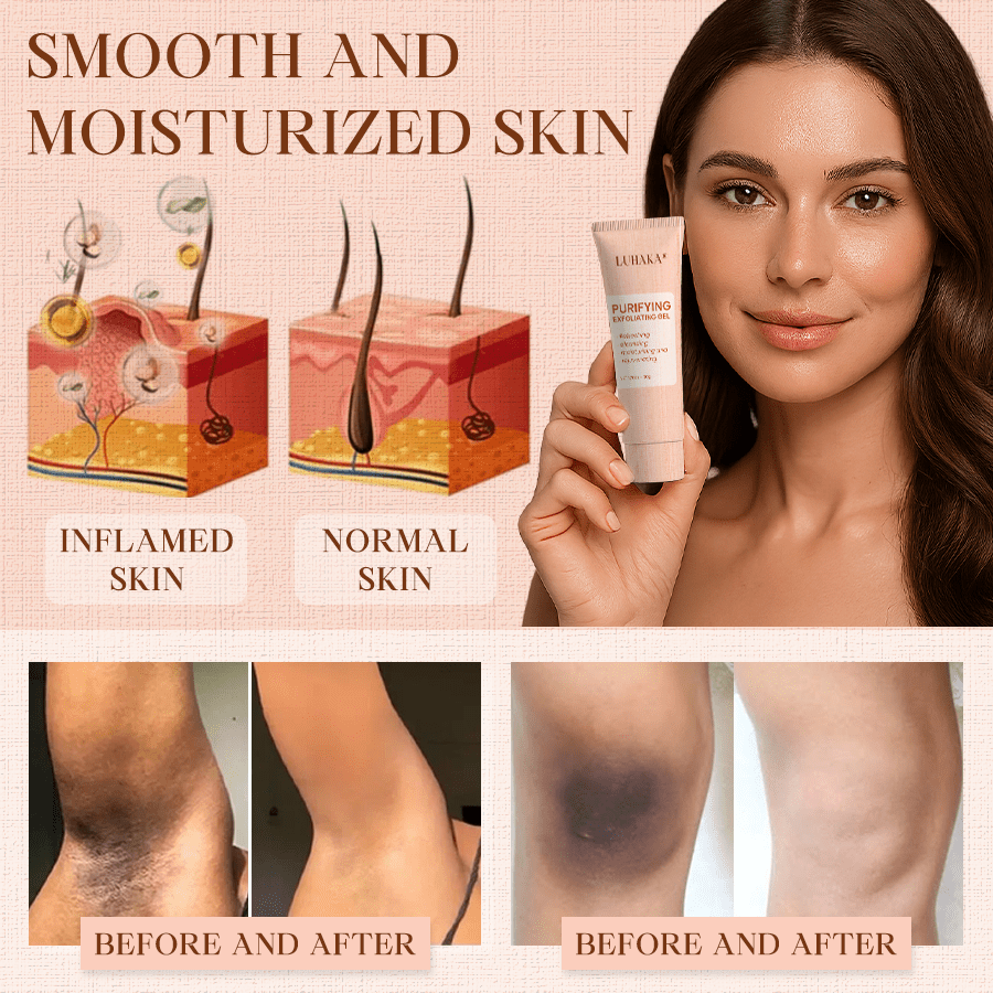 Luhaka® Purifying Exfoliating Gel ACE 13 for Acanthosis Nigricans, Exfoliation, Dark Spots, Skin Tags, and Eczema