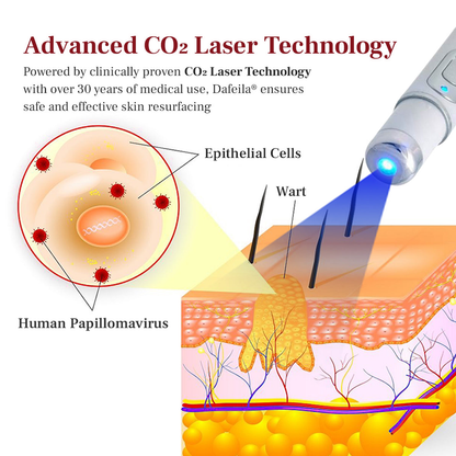 DAFEILA® LumeSkin Mole and Wart Removal Laser Pen