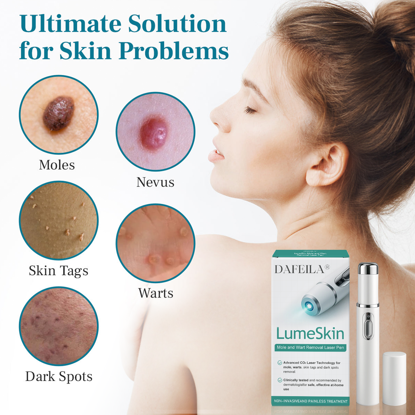 DAFEILA® LumeSkin Mole and Wart Removal Laser Pen