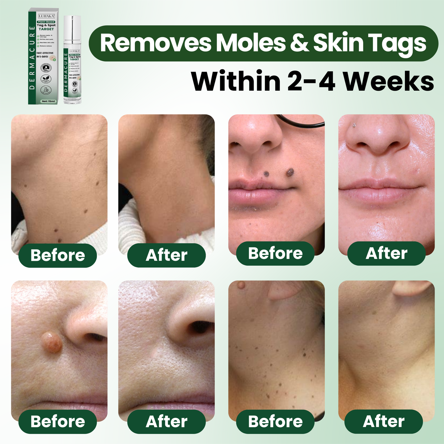 Luhaka® Reedle Shot 100 Tag & Spot Target Advanced Serum ACE