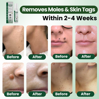 Luhaka® Reedle Shot 100 Tag & Spot Target Advanced Serum ACE