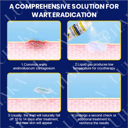 LUHAKA® SKIN TAG CRYO TREATMENT SPRAY ACE