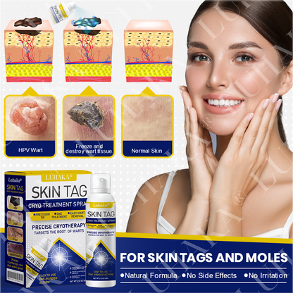 LUHAKA® SKIN TAG CRYO TREATMENT SPRAY ACE