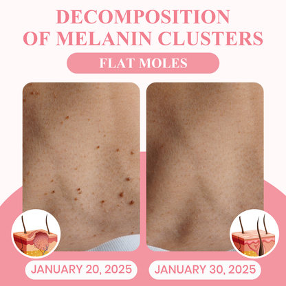 LUHAKA® Dual Acid Wart & Mole Removal Serum ACE