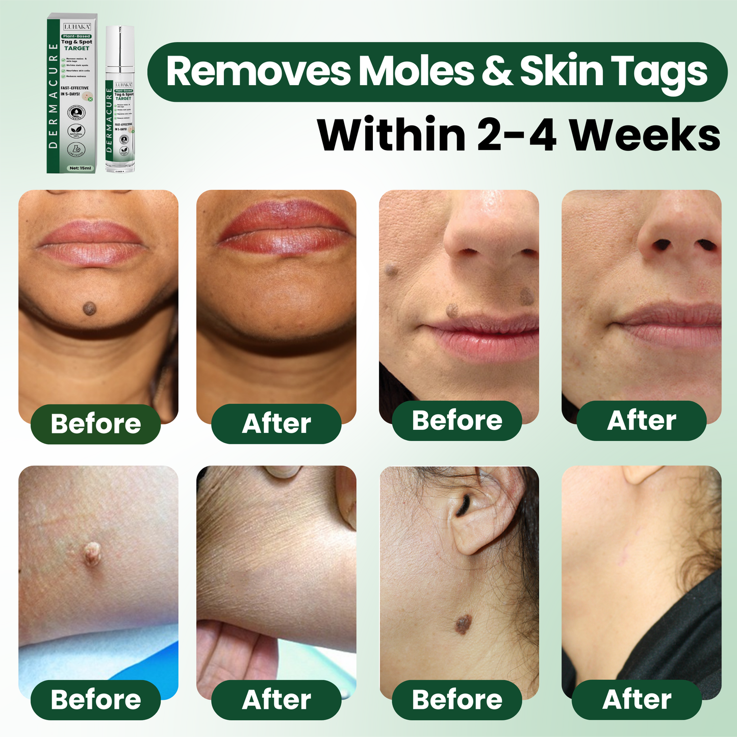 Luhaka® Reedle Shot 100 Tag & Spot Target Advanced Serum ACE