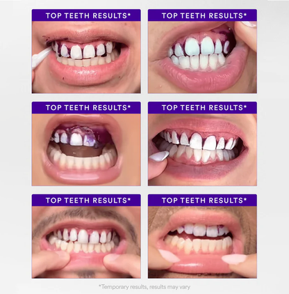 V34 Whitening Strips_Ultra01