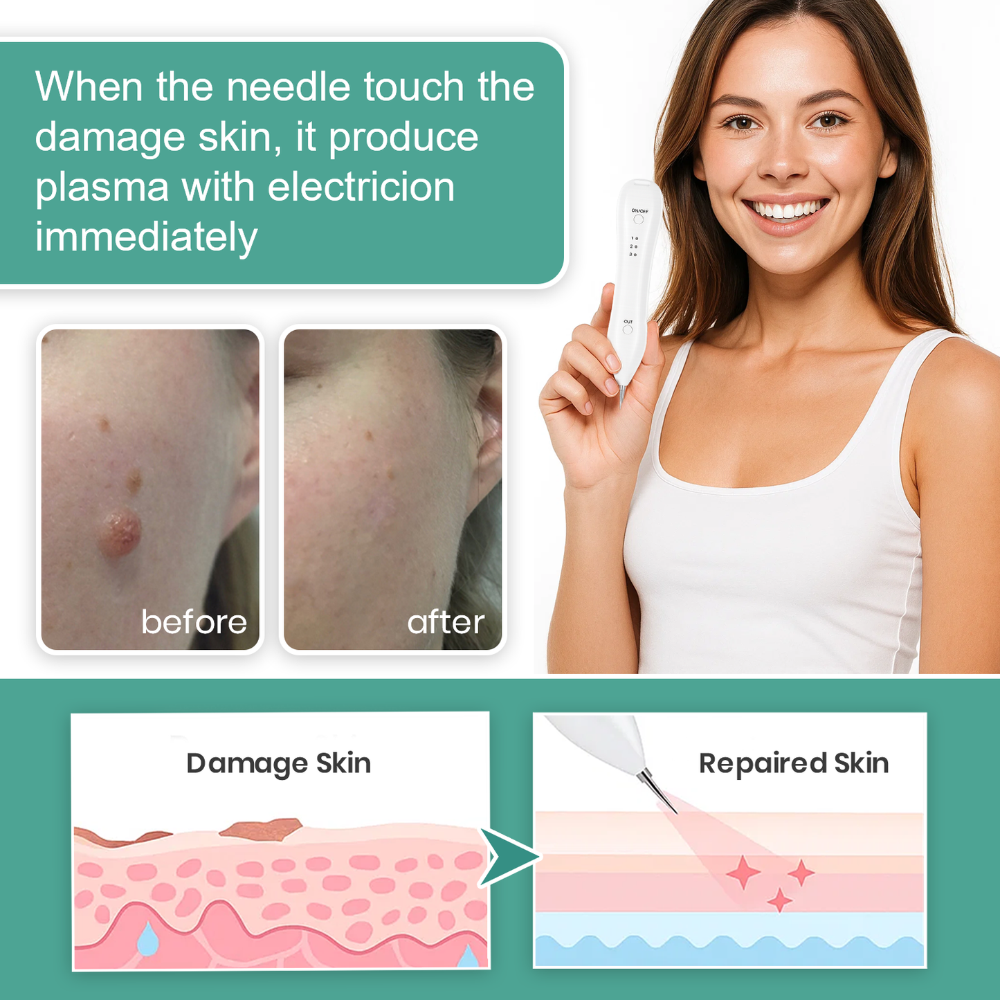 Dafeila® Advanced Plasma Laser Spot Cleaning Pen