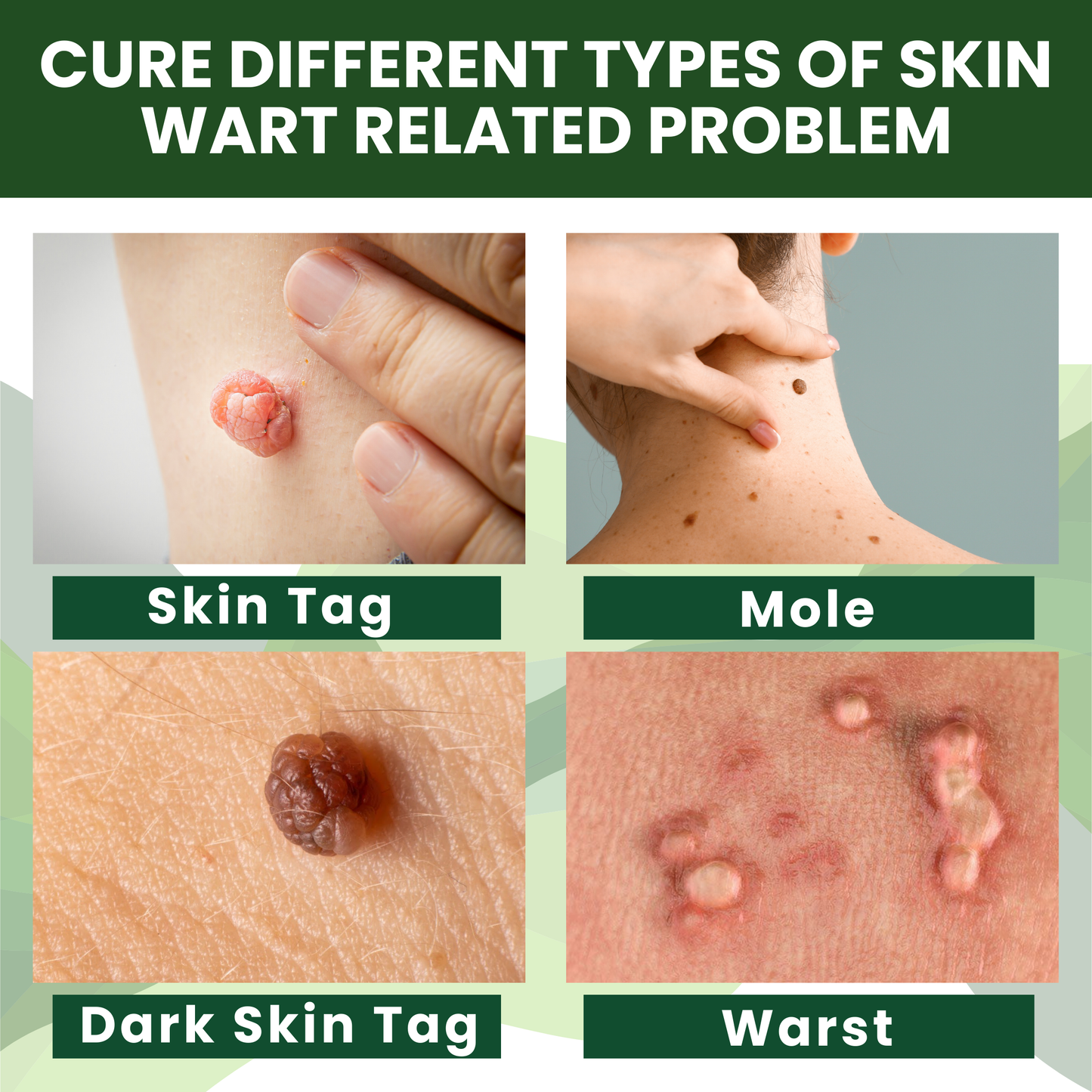 Luhaka® Reedle Shot 100 Tag & Spot Target Advanced Serum ACE