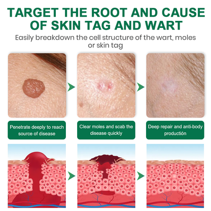 Lyyeto® Herdle Shot Spot & Mole Correct Serum ACE