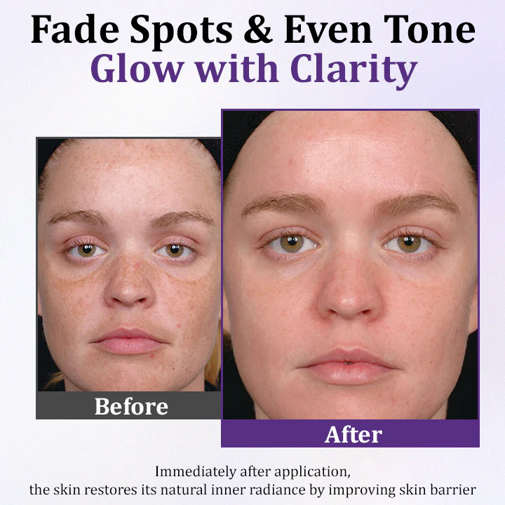 Luhaka® LumiDerma Anti-Hyperpigmentation Cream